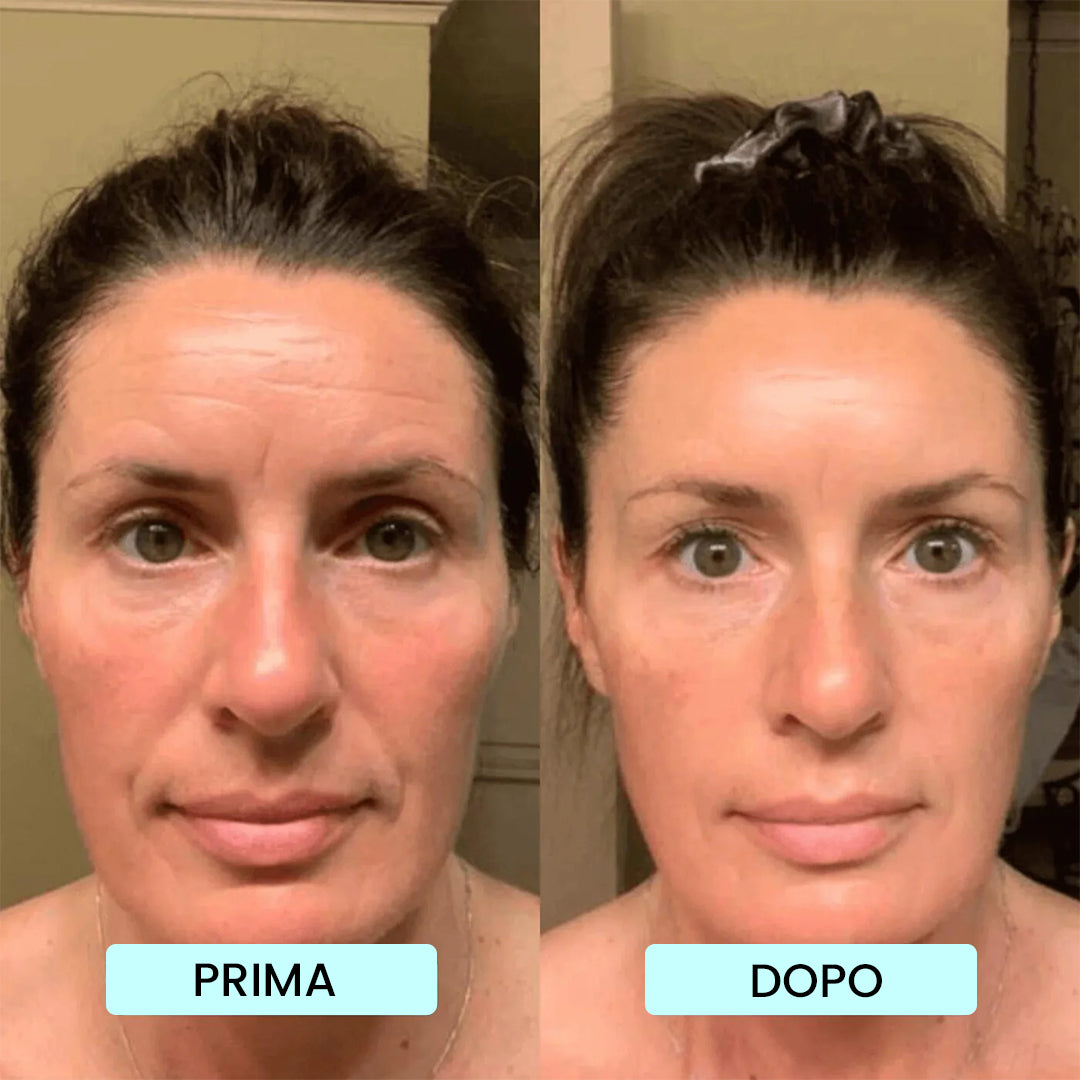 Akika - 100% Pure Marine Collagen